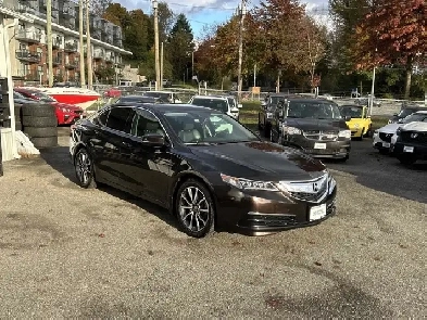 2017 Acura TLX Image# 1